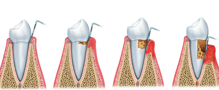 Periodontoloji 